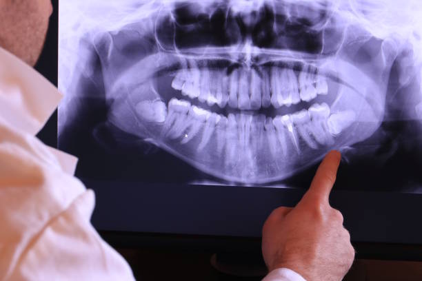 Best Emergency Tooth Extraction in Monument Beach, MA